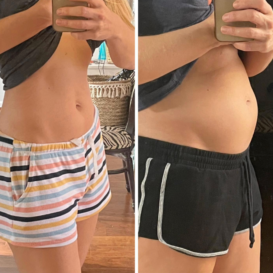 Avani - Menopausal Bloating Wellness Pack