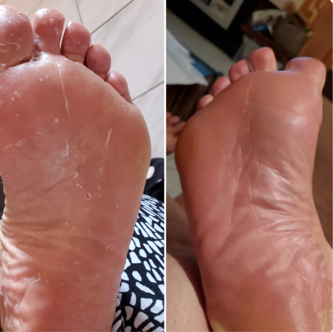 Avani Antifungal Soap
